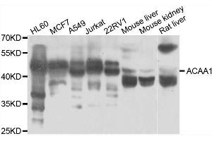 Western blot analysis of extracts of various cell lines, using ACAA1 antibody. (ACAA1 抗体  (AA 27-300))