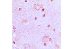 Immunohistochemical analysis of SRSF7 staining in human brain formalin fixed paraffin embedded tissue section. (SFRS7 抗体  (Center))