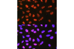 Immunofluorescence analysis of L929 cells using P4H Rabbit pAb (0538) at dilution of 1:100 (40x lens). (P4HA1 抗体  (AA 235-534))