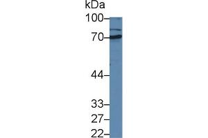 Western blot analysis of Rat Liver lysate, using Rabbit Anti-Rat MMP1 Antibody (1 µg/ml) and HRP-conjugated Goat Anti-Rabbit antibody (abx400043, 0. (MMP1 抗体  (AA 169-464))