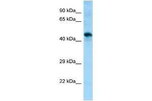 WB Suggested Anti-Sgms1 Antibody Titration: 1. (Sphingomyelin Synthase 1 抗体  (Middle Region))