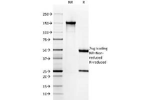SDS-PAGE Analysis Purified Cytokeratin 6A (KRT6A) Mouse Monoclonal Antibody (KRT6A/2368). (KRT6A 抗体)