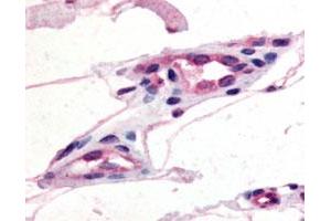 Immunohistochemical (Formalin/PFA-fixed paraffin-embedded sections) staining of human capillaries with GPR21 polyclonal antibody . (GPR21 抗体)
