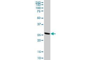 KLK10 polyclonal antibody (A01), Lot # 051011JC01 Western Blot analysis of KLK10 expression in A-431 . (Kallikrein 10 抗体  (AA 167-276))