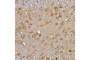 Immunohistochemistry (IHC) image for anti-GDNF Family Receptor alpha 1 (GFRA1) (AA 25-280) antibody (ABIN6141065)