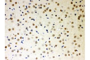 Anti- PKC iota Picoband antibody,IHC(P) IHC(P): Rat Brain Tissue (PKC iota 抗体  (AA 21-214))