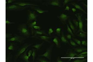 Immunofluorescence of purified MaxPab antibody to IKZF1 on HeLa cell. (IKZF1 抗体  (AA 1-477))