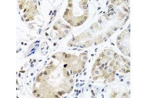 Immunohistochemistry of paraffin-embedded Human stomach using PCBP1 Polyclonal Antibody at dilution of 1:100 (40x lens). (PCBP1 抗体)