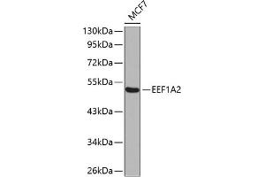 Western blot analysis of extracts of MCF-7 cells, using EEF1 antibody (ABIN6129010, ABIN6139947, ABIN6139948 and ABIN6223167). (EEF1A2 抗体  (AA 184-463))