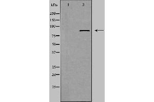 Western blot analysis of extracts from Jurkat cells using ZFYVE20 antibody. (Rabenosyn 5 抗体  (Internal Region))