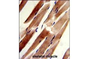 Formalin-fixed and paraffin-embedded human skeletal muscle reacted with ACTR2 Antibody , which was peroxidase-conjugated to the secondary antibody, followed by DAB staining. (ACTR2 抗体  (C-Term))