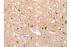 The image on the left is immunohistochemistry of paraffin-embedded Human brain tissue using ABIN7190855(GPR6 Antibody) at dilution 1/10, on the right is treated with synthetic peptide. (GPR6 抗体)