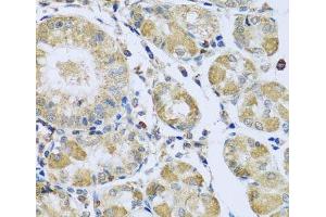 Immunohistochemistry of paraffin-embedded Human stomach using PMPCB Polyclonal Antibody at dilution of 1:100 (40x lens). (PMPCB 抗体)
