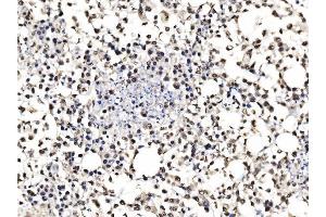 IHC analysis of DBC-1/CCAR2 using anti-DBC-1/CCAR2 antibody (ABIN7602235). (CCAR2 抗体  (AA 65-917))