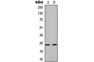 Western blot analysis of PLUNC expression in A549 (A), PC12 (B) whole cell lysates. (BPIFA1 抗体  (Center))