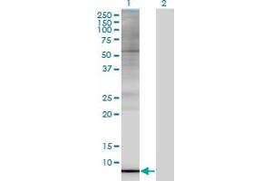 Western Blot analysis of ARL9 expression in transfected 293T cell line by ARL9 monoclonal antibody (M02A), clone 7A2. (ARL9 抗体  (AA 1-123))