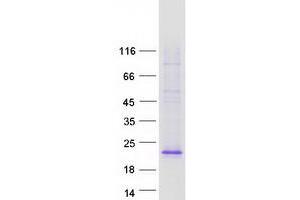 Western Blotting (WB) image for Ectodysplasin A (EDA) (Transcript Variant 3) protein (Myc-DYKDDDDK Tag) (ABIN2719927)