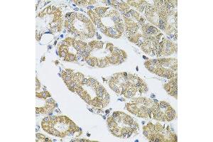 Immunohistochemistry of paraffin-embedded human stomach using VEPH1 antibody. (VEPH1 抗体  (AA 448-547))