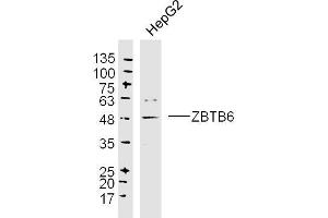 HepG2 lysates probed with ZBTB6 Polyclonal Antibody, Unconjugated  at 1:300 dilution and 4˚C overnight incubation. (ZBTB6 抗体  (AA 351-424))