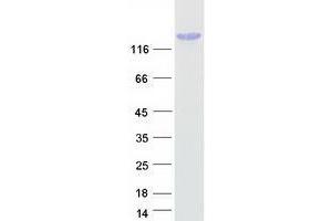 Western Blotting (WB) image for Treacher Collins-Franceschetti Syndrome 1 (TCOF1) (Transcript Variant 3) protein (Myc-DYKDDDDK Tag) (ABIN2734193)