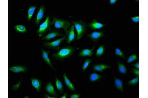 Immunofluorescence staining of A549 cells with ABIN7173123 at 1:133, counter-stained with DAPI. (TMEM192 抗体  (AA 193-271))