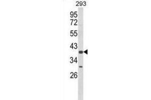 Western Blotting (WB) image for anti-Chondroitin Sulfate N-Acetylgalactosaminyltransferase 2 (CSGALNACT2) antibody (ABIN3003905) (CSGALNACT2 抗体)