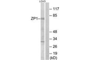 Western Blotting (WB) image for anti-Zona Pellucida Glycoprotein 1 (ZP1) (AA 221-270) antibody (ABIN2890710) (ZP1 抗体  (AA 221-270))