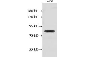 Western Blot analysis of A431 cell using GUSB Polyclonal Antibody at dilution of 1:500 (Glucuronidase beta 抗体)