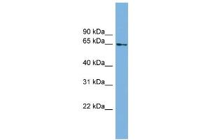 WB Suggested Anti-C8orf45 Antibody Titration: 0. (C8orf45 抗体  (Middle Region))