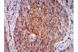 Immunohistochemistry (IHC) image for anti-V-Ral Simian Leukemia Viral Oncogene Homolog B (Ras Related, GTP Binding Protein) (Ralb) (AA 89-206) antibody (ABIN5542685)