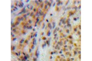 Used in DAB staining on fromalin fixed paraffin-embedded Ovary tissue (TOP2 抗体  (AA 923-1148))