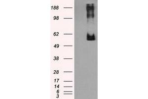 HEK293T cells were transfected with the pCMV6-ENTRY control (Left lane) or pCMV6-ENTRY LIPG (Right lane) cDNA for 48 hrs and lysed. (LIPG 抗体)