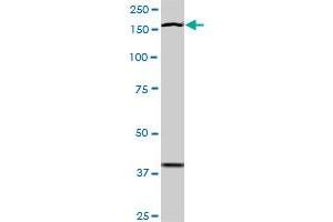 Western Blotting (WB) image for anti-TEK Tyrosine Kinase, Endothelial (TEK) (AA 66-185) antibody (ABIN793004) (TEK 抗体  (AA 66-185))