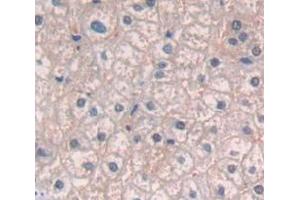 IHC-P analysis of Human Tissue, with DAB staining. (IL12RB2 抗体  (AA 559-647))