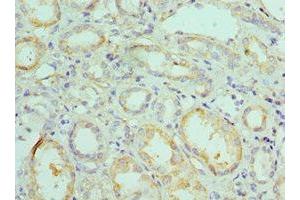 Immunohistochemistry of paraffin-embedded human kidney tissue using ABIN7145331 at dilution of 1:100 (BNIP3 抗体  (AA 1-164))