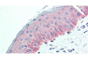Immunohistochemistry of paraffin-embedded Human Skin using NECTIN4 Polyclonal Antibody at dilution of 1:90. (PVRL4 抗体)