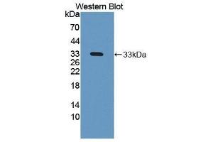 Western Blotting (WB) image for anti-N-Acetyl alpha-D-Glucosaminidase (AA 485-743) antibody (ABIN1869393)