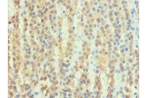 Immunohistochemistry (IHC) image for anti-ATPase, H+ Transporting, Lysosomal Accessory Protein 2 (ATP6AP2) (AA 251-350) antibody (ABIN7167679)