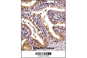 PHLDA2 Antibody immunohistochemistry analysis in formalin fixed and paraffin embedded human prostate tissue followed by peroxidase conjugation of the secondary antibody and DAB staining.