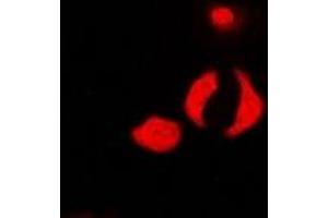 Immunofluorescent analysis of PP1 beta staining in U2OS cells. (Serine/threonine-Protein Phosphatase PP1-beta Catalytic Subunit (PP1-BETA) 抗体)