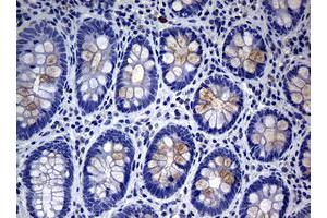 Image no. 1 for anti-Mucin 16, Cell Surface Associated (CA125) (AA 10329-10628) antibody (ABIN1490812) (MUC16 抗体  (AA 10329-10628))