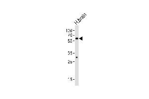 Western blot analysis of lysate from human brain tissue lysate, using ZN Antibody (C-term) (ABIN6242707 and ABIN6577591). (ZNF610 抗体  (C-Term))