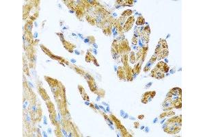 Immunohistochemistry of paraffin-embedded Mouse heart using COL9A3 Polyclonal Antibody at dilution of 1:100 (40x lens). (COL9A3 抗体)