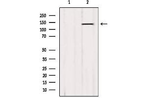 Western blot analysis of extracts from B16F10, using QSK Antibody. (SIK3 抗体  (Internal Region))