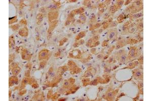 IHC image of ABIN7127645 diluted at 1:100 and staining in paraffin-embedded human liver tissue performed on a Leica BondTM system. (Recombinant NPC1L1 抗体)