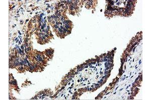 Image no. 5 for anti-IlvB (Bacterial Acetolactate Synthase)-Like (ILVBL) antibody (ABIN1498878)