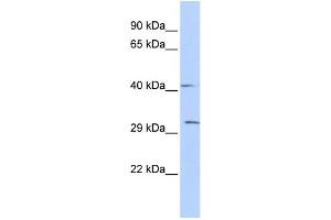 WB Suggested Anti-ZFP36 Antibody Titration:  0. (ZFP36 抗体  (Middle Region))