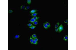 Immunofluorescent analysis of HepG2 cells using ABIN7173277 at dilution of 1:100 and Alexa Fluor 488-congugated AffiniPure Goat Anti-Rabbit IgG(H+L) (TMEM82 抗体  (AA 168-202))