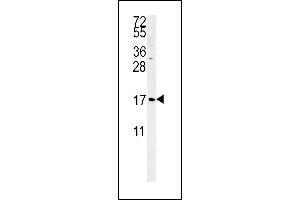 SGP Antibody (Center)&65288,Cat(ABIN651464 and ABIN2840255)&65289,western blot analysis in K562 cell line lysates (35 μg/lane). (SMAGP 抗体  (AA 46-75))