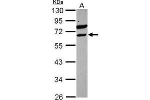 WB Image Sample (30 ug of whole cell lysate) A: Raji 10% SDS PAGE antibody diluted at 1:1000 (ETV6 抗体)
